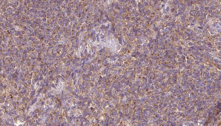 RASGRP3 / GRP3 Antibody