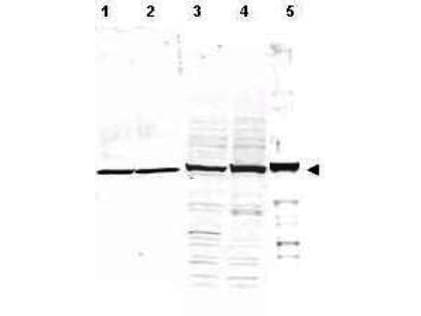 IHC-plus™ Polyclonal Rabbit anti-Human Alpha Tubulin Antibody (aa425-451, IHC, IF, WB)