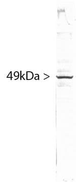 IHC-plus™ Monoclonal Mouse anti-Human SF3B4 Antibody (clone 3A1, IHC, IF, WB)