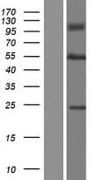 Human ABLIM2 Protein (Over-Expression Lysate Myc-DDK (Flag))