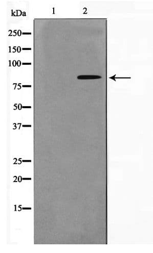 Polyclonal Rabbit anti-Human NBN / Nibrin Antibody (phospho-Ser278, IF, WB)