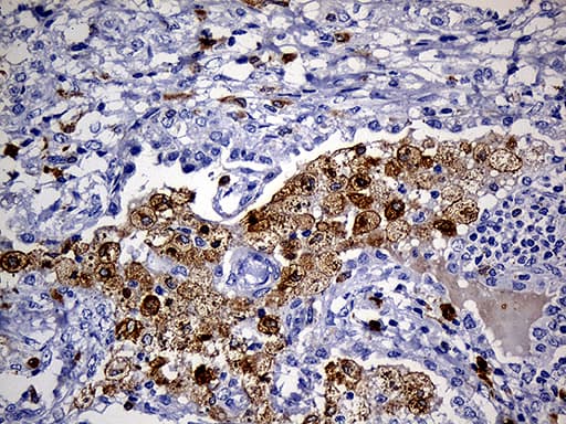Monoclonal Mouse anti-Human CD68 Antibody (clone OTI2E2, aa22-319, IHC, WB)