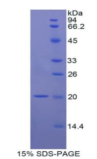 Rat IL17B Protein (Recombinant His)