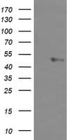 Monoclonal Mouse anti-Human UBOX5 Antibody (clone OTI 4C1, WB)
