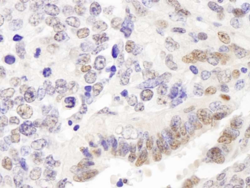 Polyclonal Rabbit anti-Human GATAD2A Antibody (aa573-633, IHC)
