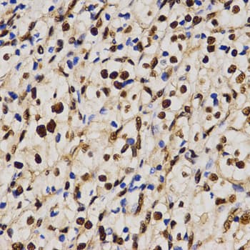 IHC-plus™ Polyclonal Rabbit anti-Human SKIV2L2 Antibody (IHC, WB)