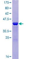Human BLOC1S2 Protein (Recombinant GST)