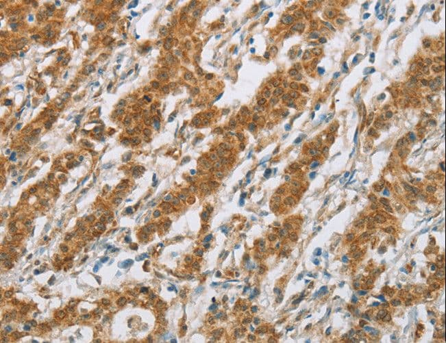 CYP2E1 Antibody