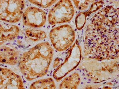 PSMB2 Antibody