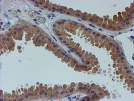 ER Alpha / Estrogen Receptor Antibody (clone OTI1B1)