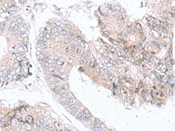 IQCD Antibody