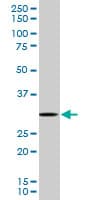 RPS3 / Ribosomal Protein S3 Antibody (clone 2A8)