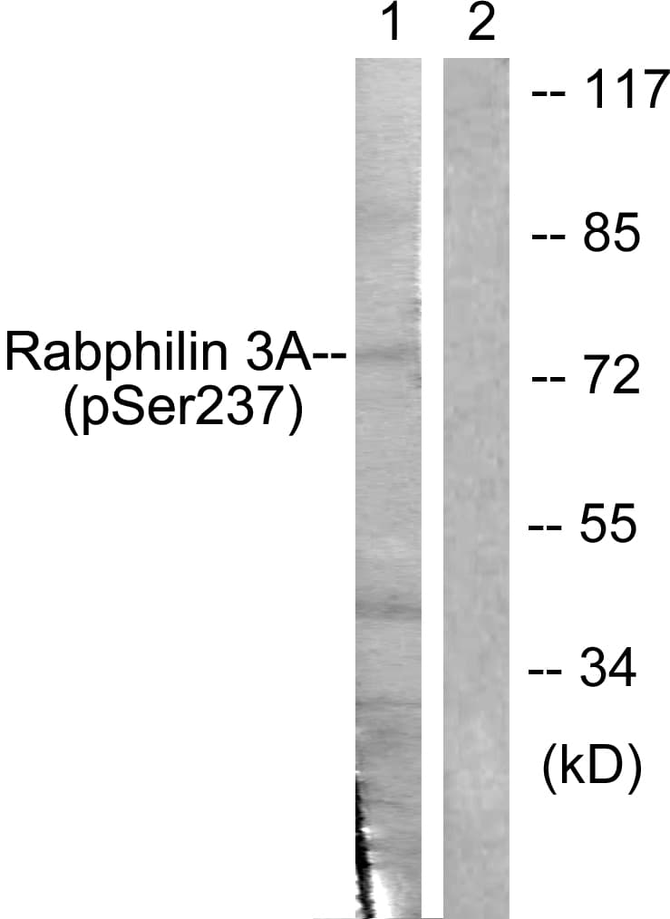 Polyclonal Rabbit anti-Human RPH3A / Rabphilin 3A Antibody (phospho-Ser237, IHC, IF, WB)