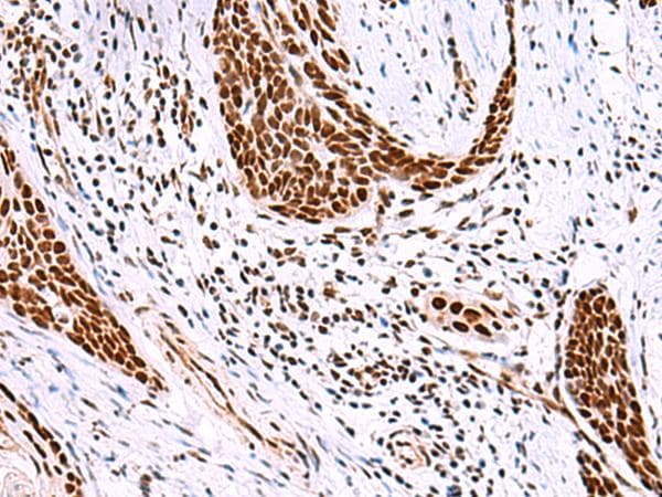 ISY1-RAB43 Antibody