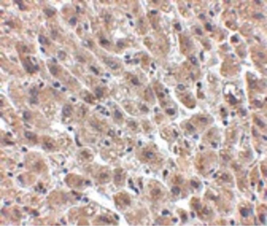 Polyclonal Chicken anti-Human ALB / Serum Albumin Antibody (IHC, IF, WB)