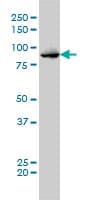 IHC-plus™ Monoclonal Mouse anti-Human MPS1 / TTK Antibody (clone 3G7, IHC, WB)