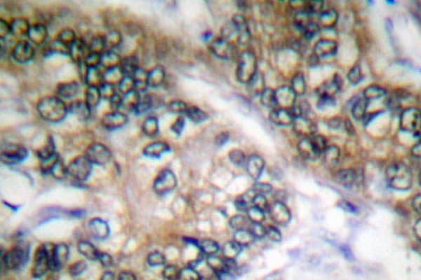 ESPL1 / Separase Antibody (Ala795)