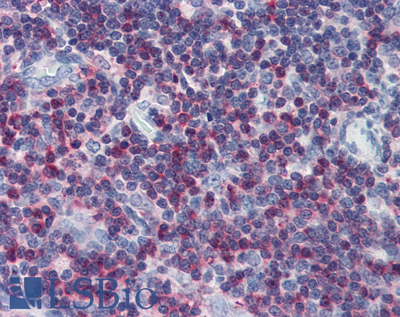 IHC-plus™ LCP2 / SLP-76 Antibody (aa216-434, clone Polyclonal)