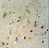 Polyclonal Rabbit anti-Human CHF1 / HEY2 Antibody (aa65-91, IHC, WB)