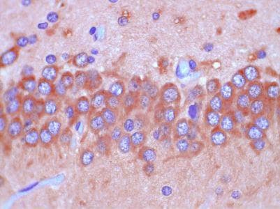 C5AR2 / GPR77 / C5L2 Antibody (clone 1A6)