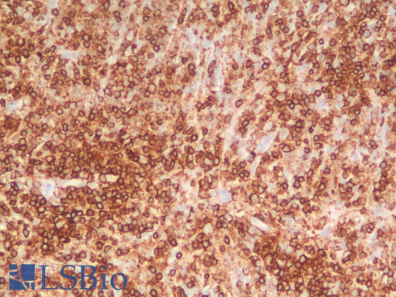PathPlus™ CD45 / LCA Antibody (clone PTPRC/1783R + PTPRC/1975R)