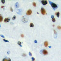 CHRAC1 Antibody (C-Terminus)