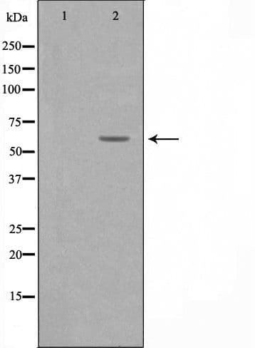 Polyclonal Rabbit anti-Human KCNC1 / Kv3.1 Antibody (IF, WB)