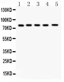 FSH Receptor / FSHR Antibody