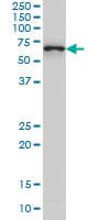 CTNNBL1 / NAP Antibody (clone 5F1)