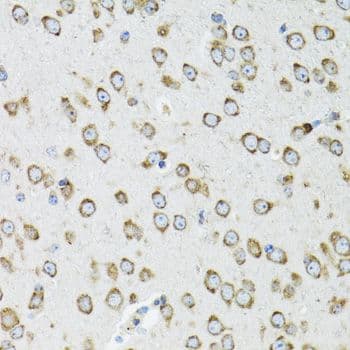 OGDH Antibody
