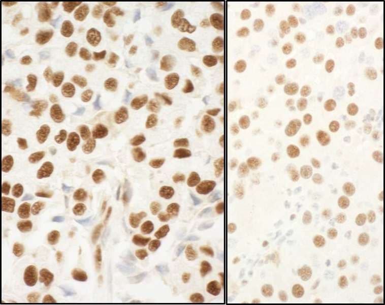 NPM1 / NPM / Nucleophosmin Antibody (aa250-294)