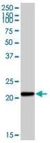 CYBA / p22phox Antibody (clone 44.1)
