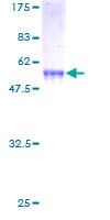 Human 15-PGDH / HPGD Protein (Recombinant GST)