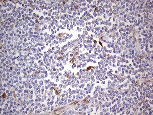 Monoclonal Mouse anti-Human LGALS3 / Galectin 3 Antibody (clone OTI15E4, IHC, WB)