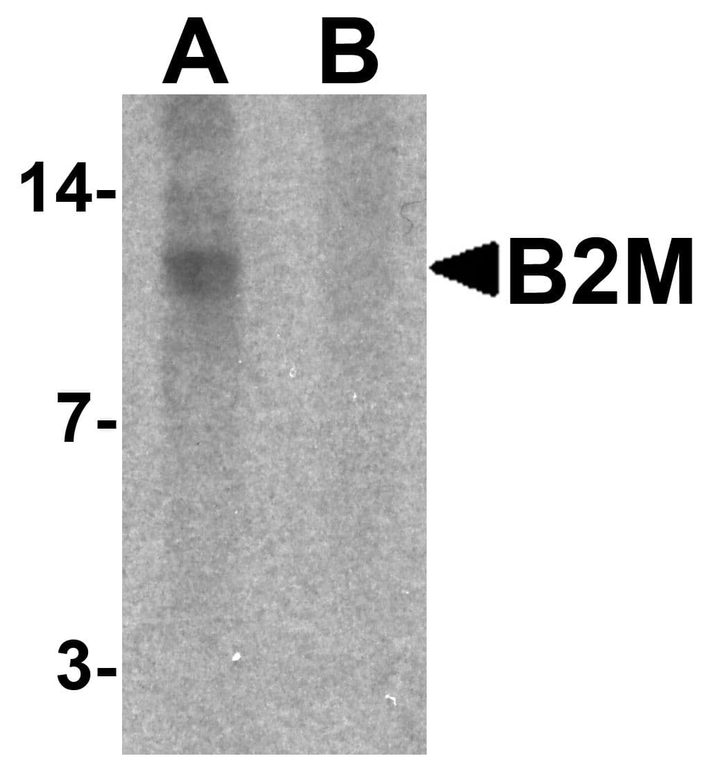 IHC-plus™ B2M / Beta 2 Microglobulin Antibody