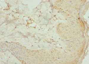 AGPAT2 Antibody