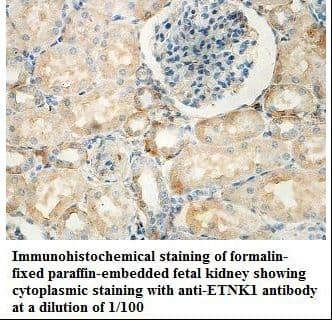 ETNK1 / Ethanolamine Kinase 2 Antibody (aa270-452)