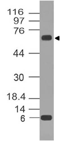 TP73 / p73 Antibody