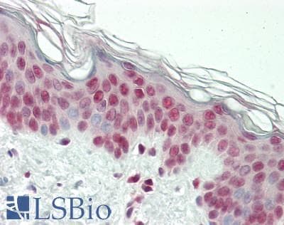 IHC-plus™ Polyclonal Rabbit anti-Human NR3C1/Glucocorticoid Receptor Antibody (IHC, IF, WB)