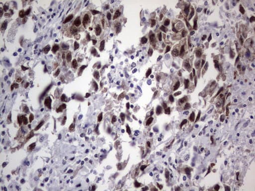 Monoclonal Mouse anti-Human DDX56 Antibody (clone UMAB152, Carrier-free, aa323-547, IHC, IF, WB)