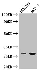 IHC-plus™ Polyclonal Rabbit anti-Human NUDT21 Antibody (IHC)