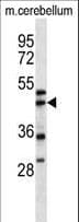 Polyclonal Rabbit anti-Human ACTR1A / Centractin Antibody (aa98-126, WB)