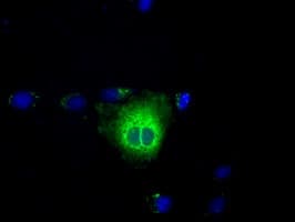 TS / Thromboxane Synthase Antibody (clone OTI1A12)