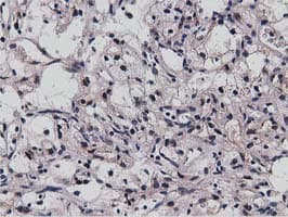 NT5DC1 Antibody (clone OTI2B12)