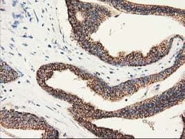 CLPP Antibody (clone OTI1G9)