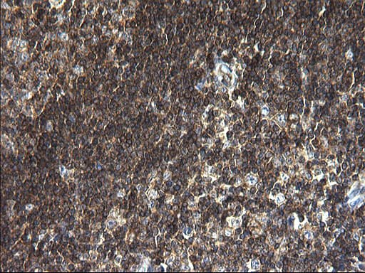 ANKMY2 Antibody (clone OTI1F11)