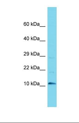 Polyclonal Rabbit anti-Human C9orf170 Antibody (aa21-70, WB)