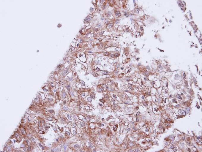 KCNJ3 / GIRK1 Antibody (aa248-501)