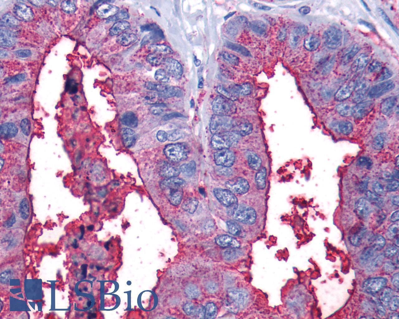 PathPlus™ LTB4R2 / BLT2 Antibody (Cytoplasmic Domain)