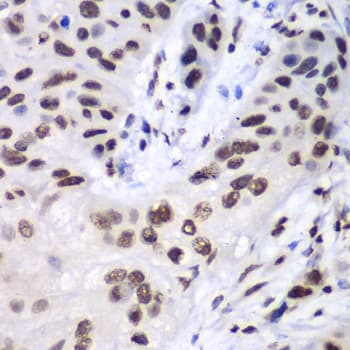 IHC-plus™ LIG3 / DNA Ligase III Antibody